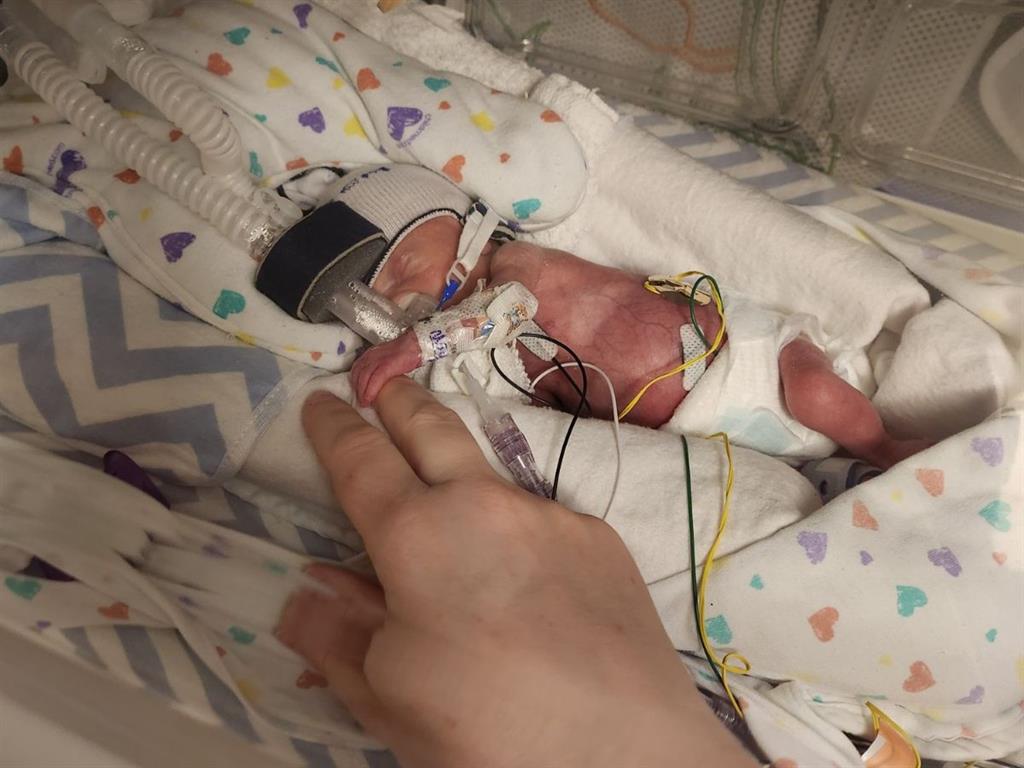Infant in NICU bed hooked up to a ventilator